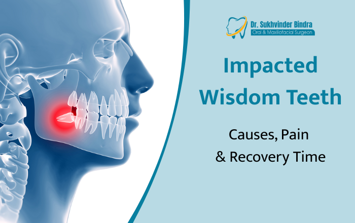 Impacted Wisdom Teeth: Causes, Pain Stages, and Recovery Time