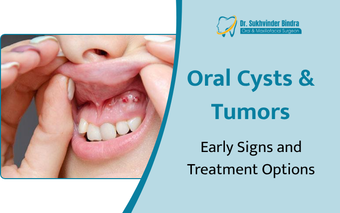 Oral Cysts & Tumors: Early Signs and Treatment Options